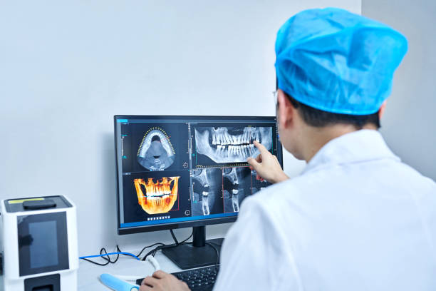 Best Emergency Wisdom Teeth Removal in Meridian Hills, IN